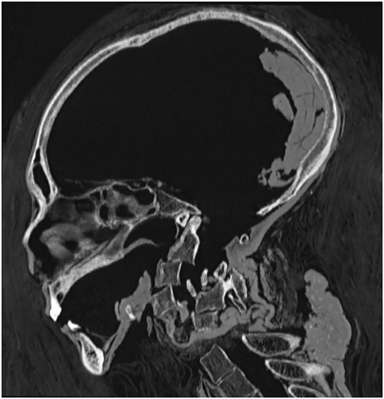Imagem relacionada a Tomografia computadorizada é usada para ver virtualmente o sarcófago de uma múmia