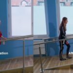 Imagem relacionada a Exoesqueleto permite que pessoas com esclerose múltipla possam andar